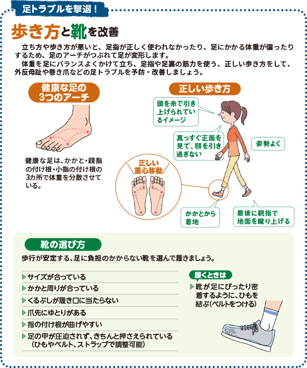 足トラブルと撃退! 歩き方と靴を改善 立ち方や歩き方が悪いと、足指が正しく使われなかったり、足にかかる体重がかたよったりするため、足のアーチがつぶれて足が変形します。体重を足にバランスよくかけて立ち、足指や足裏の筋力を使う、正しい歩き方をして、外反母趾や巻き爪などの足トラブルを予防・改善しましょう。 靴の選び方 歩行が安定する、足に負担がかからない靴を選んで履きましょう。